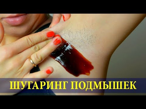 Видео: ШУГАРИНГ ПОДМЫШЕК В ДОМАШНИХ УСЛОВИЯХ | ТЕХНИКА УДАЛЕНИЯ ВОЛОС C ПОДМЫШЕК 4:10 | DYI ARMPITS REMOVAL