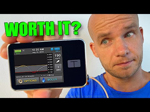 Видео: Tandem t:slim X2: полный обзор инсулиновой помпы