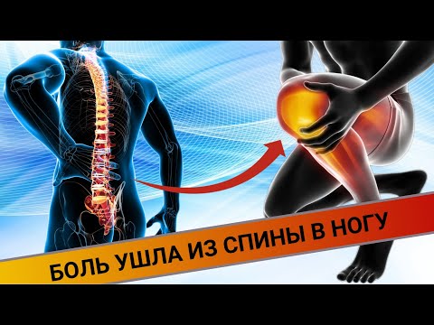 Видео: БОЛЬ УШЛА ИЗ СПИНЫ В НОГУ