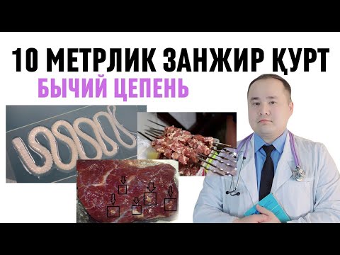 Видео: 10 МЕТРЛИК ҚУРТ ҚОРАМОЛ СОЛИТЁРИ, БЫЧЫЙ ЦЕПЕНЬ, ТЕНИАРИНХОЗ ХАҚИДА БАФУРЖА ИСЧАНОВ, ГЎШТДАН ЭХТИЁТ