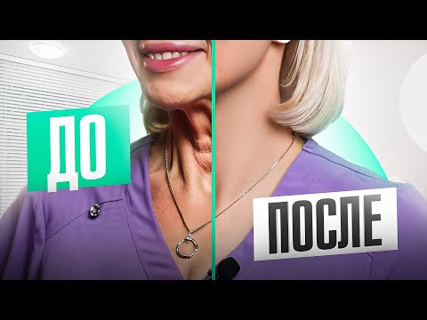 Видео: Молодая ШЕЯ. Что можно делать в клинике, а что дома? – СПИСОК ПРОЦЕДУР