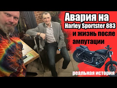 Видео: Авария на sportster 883 и жизнь после ампутации. Реальная история.