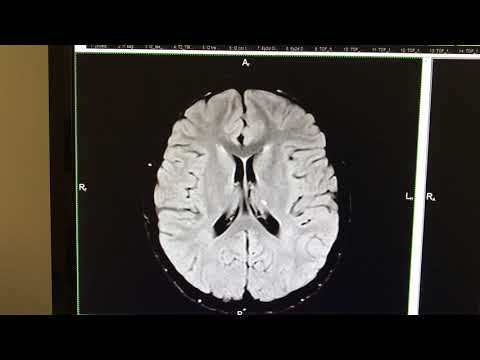 Видео: МРТ детям