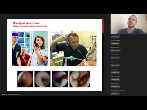 Видео: Лечение различных повреждений дыхательных путей и пищевода литиевой батарейкой - Степаненко Н.С.
