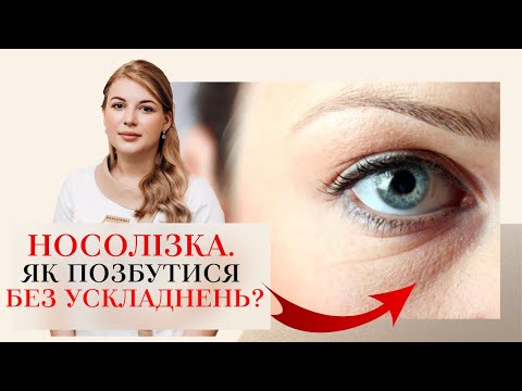 Видео: НОСОСЛІЗНА БОРОЗНА ⁉️ЯК ПОЗБУТИСЯ ⁉️🤯