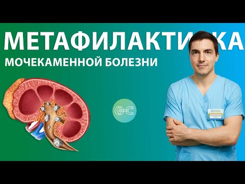 Видео: Метафилактика мочекаменной болезни