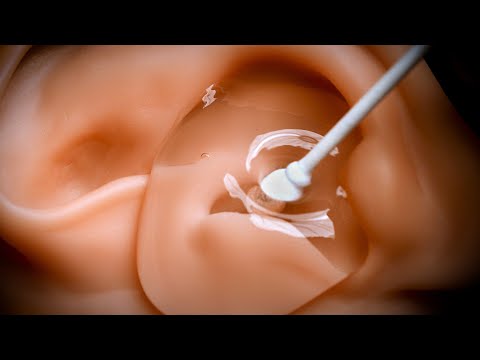 Видео: [ASMR] Удовлетворительная очистка ушей при уровне давления воды 999 на барабанную перепонку (ACMP)