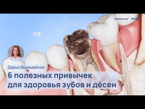 Видео: Здоровье зубов и десен: что вы делаете не так?