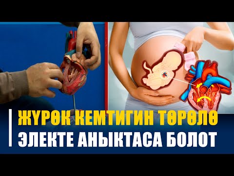 Видео: Тубаса ЖҮРӨК кемтигин ТӨРӨЛӨ электе АНЫКТАСА болот