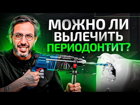 Видео: Воспаление корня зуба. Как лечить периодонтит и когда можно НЕ удалять зуб?