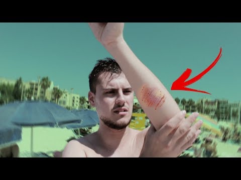 Видео: ме касна медуза