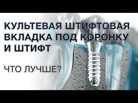 Видео: Штифт или культевая вкладка под коронку: что лучше?