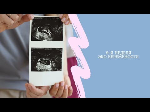 Видео: 9я неделя ЭКО беременности
