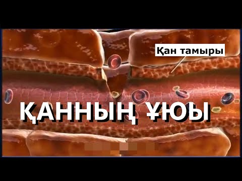 Видео: Қанның ұюы (Тромб) / Гемостаз