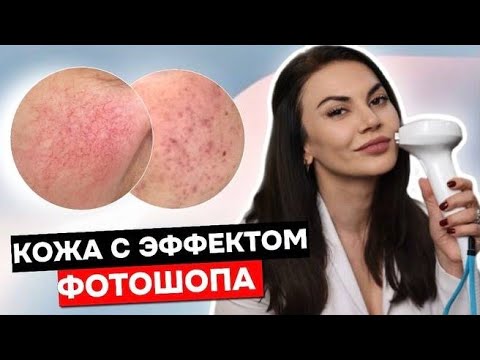 Видео: КОЖА С ЭФФЕКТОМ ФОТОШОПА: процедура Lumecca