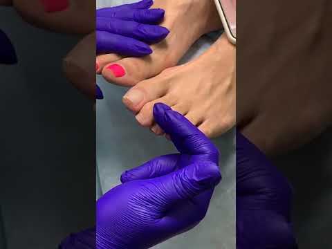 Видео: romanova nails Педикюр  Обработка пальчиков