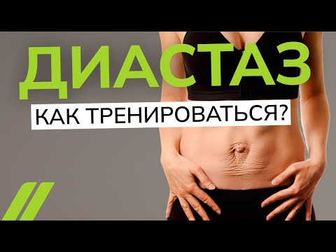 Видео: Восстановление после родов. Как тренироваться при диастазе