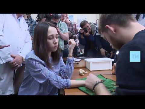 Видео: Установка протеза руки "КИБИ" в Казани