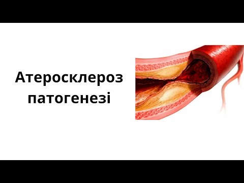 Видео: Атеросклероз
