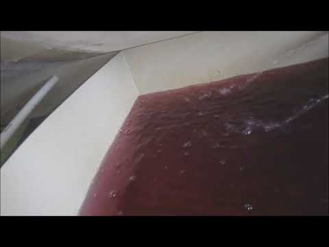 Видео: попытка лечения ожоговой болезни