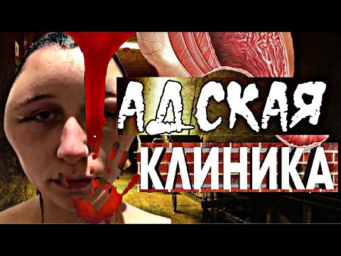 Видео: ТРЕШ ОБЗОР АДСКОЙ КЛИНИКИ😱😱😱БАЛЛОНЫ В ЖЕЛУДКЕ,ОПАСНАЯ БЛЕФАРОПЛАСТИКА,ПАЛЕНЫЙ СМАС ⚠️😱😱😱
