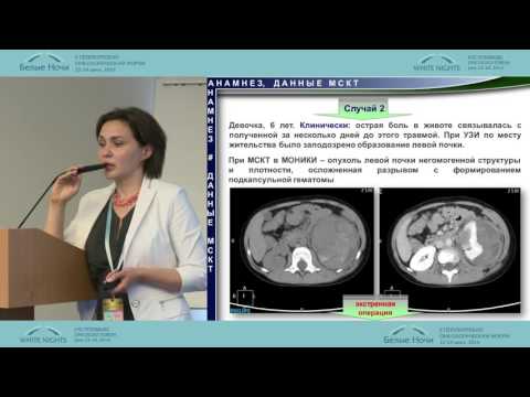 Видео: Опухоль Вильмса. Диагностика и лечение