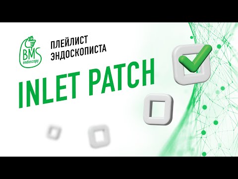 Видео: 🟢Inlet Patch /пятно пищевода #playlistэндоскописта  #эгдс #гетеротопияпищевода