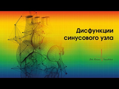 Видео: Дисфункции синусового узла