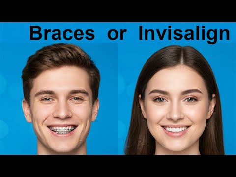 Видео: Брекеты или Invisalign? Что подходит именно вам?