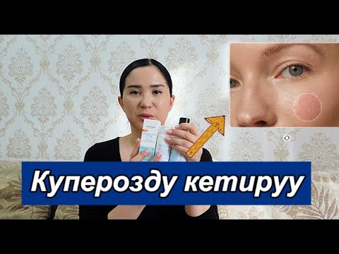 Видео: Куперозды кетируу