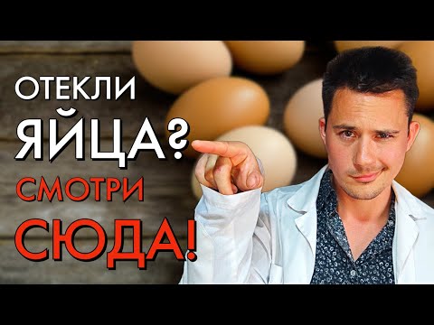 Видео: Отек яичка и мошонки | 7 главных причин | Орхоэпидидимит, варикоцеле, водянка, паховая грыжа и...