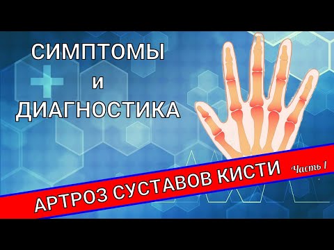 Видео: АРТРОЗ СУСТАВОВ КИСТИ (Часть 1)