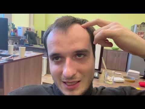 Видео: Принимал Финастерид 1 год! Результат до и после.