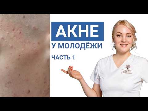 Видео: Акне у молодёжи. Откуда берутся "прыщи", что с ними делать? Наследственность играет роль? Часть1.