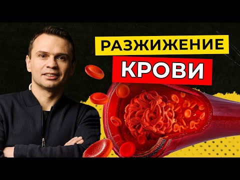 Видео: Разжижение крови | Среда с Доктором Тиграном
