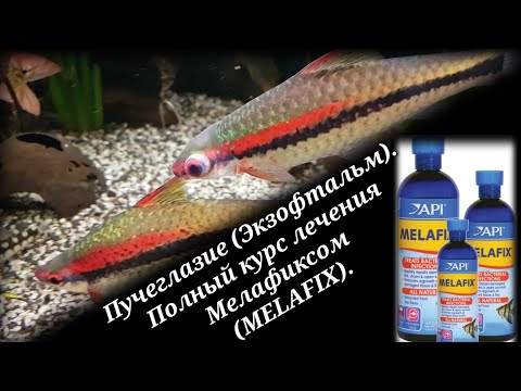 Видео: Пучеглазие (Экзофтальм). Полный курс лечения Мелафиксом (MelaFix).