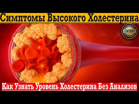 Видео: Как узнать уровень холестерина без анализов. Понижаем холестерин без лекарств в домашних условиях.