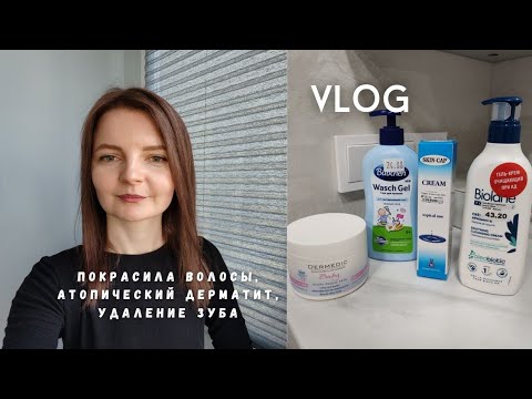 Видео: Покрасила волосы, атопический дерматит, магазин Подружка в Тринити, удаление зуба перед имплантацией