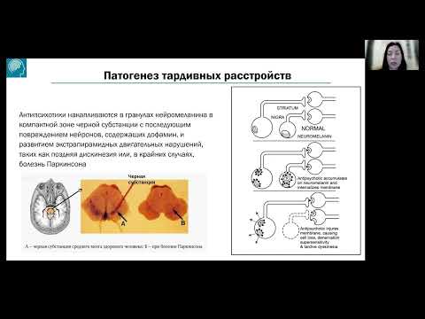 Видео: Милюхина Ирина Валентиновна Острые и тардивные вторичные расстройства движения...