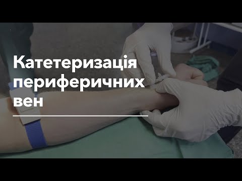 Видео: Катетеризація периферичних вен | Peripheral Venous Cannulation