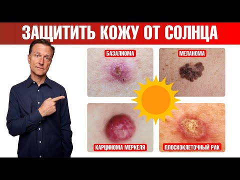 Видео: Как получить витамин Д от солнца и избежать рака кожи?😲