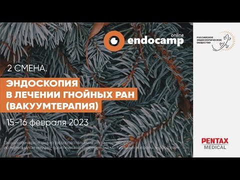 Видео: Эндоскопия в лечении гнойных ран (вакуумтерапия). день 2