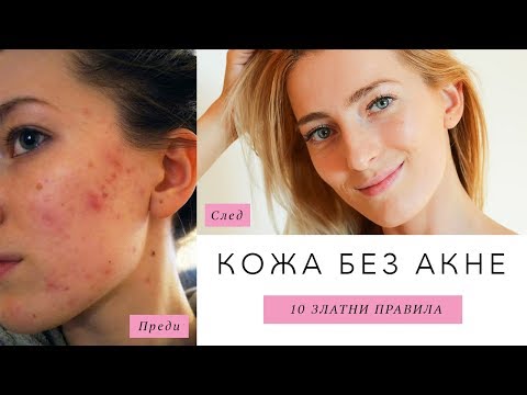 Видео: ГРИЖАТА ЗА КОЖАТА  | ЛЕЧЕНИЕ НА АКНЕ | 2 ГОДИНИ СЛЕД ЛЕЧЕНИЕ НА АКНЕ С РОАКУТАН