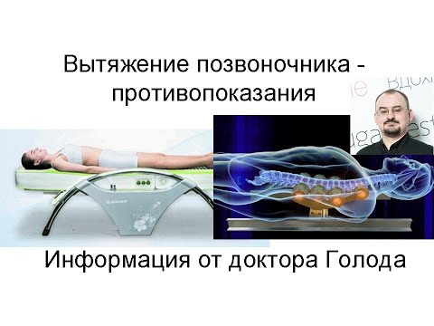 Видео: Противопоказания для вытяжения позвоночника на ролах