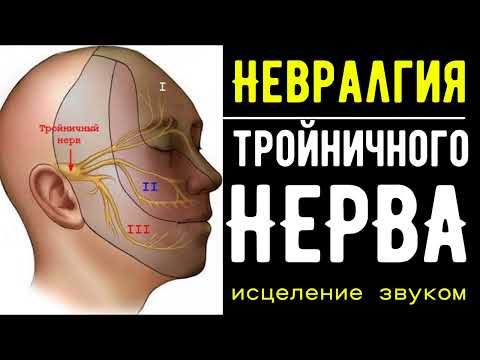 Видео: Квантовое исцеление боли в мышцах✨Невралгия Тройничного Нерва✨Частоты, Гц