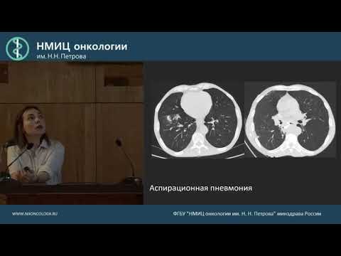 Видео: Легочные инфекционные осложнения у онкологических больных