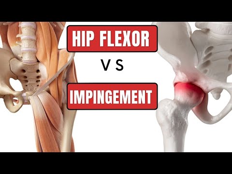 Видео: Получите правильный диагноз: FAI (импинджмент) или растяжение сгибателя бедра?