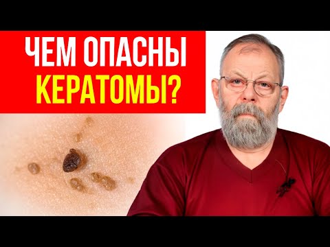 Видео: Кератомы, пятна, зуд. Как помочь себе за 5 секунд