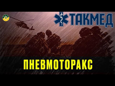 Видео: ТАКМЕД. Пневмоторакс. Випуск 9