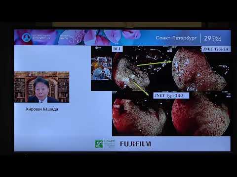 Видео: 31 Fujifilm Cad Eye Искусственный Интеллект 2 Hiroshi Kashida Обнаружение и Диагностика предраковых